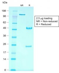 Data from SDS-PAGE analysis of Anti-Glypican-3 antibody (Clone rGPC3/863). Reducing lane (R) shows heavy and light chain fragments. NR lane shows intact antibody with expected MW of approximately 150 kDa. The data are consistent with a high purity, intact mAb.